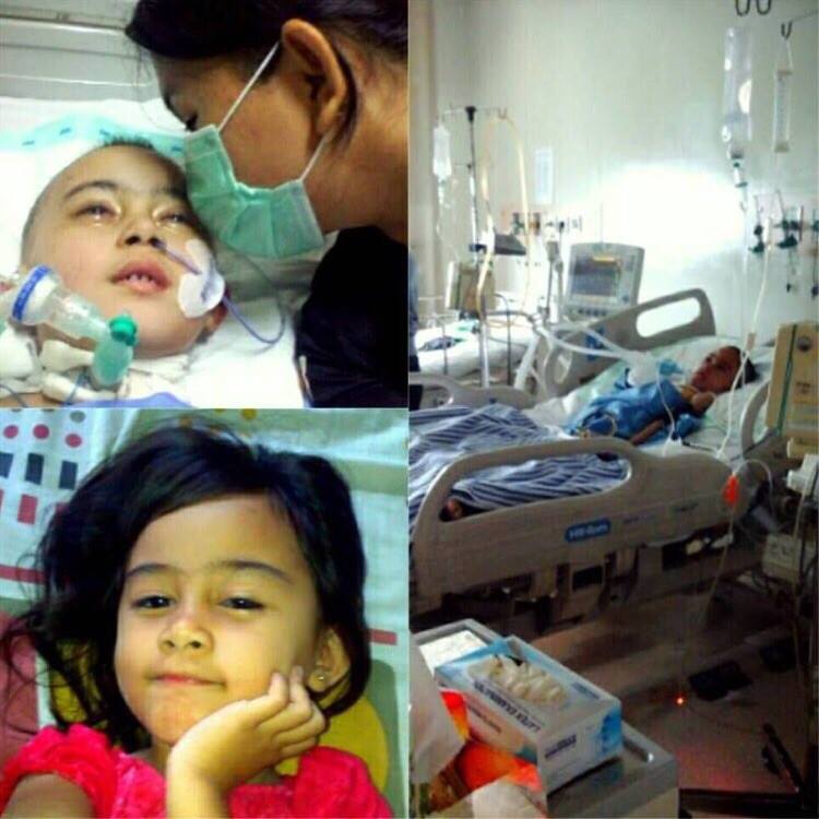 Yuk Bantu Alyshia Naomi, Gadis Kecil Penderita Tumor Otak 1