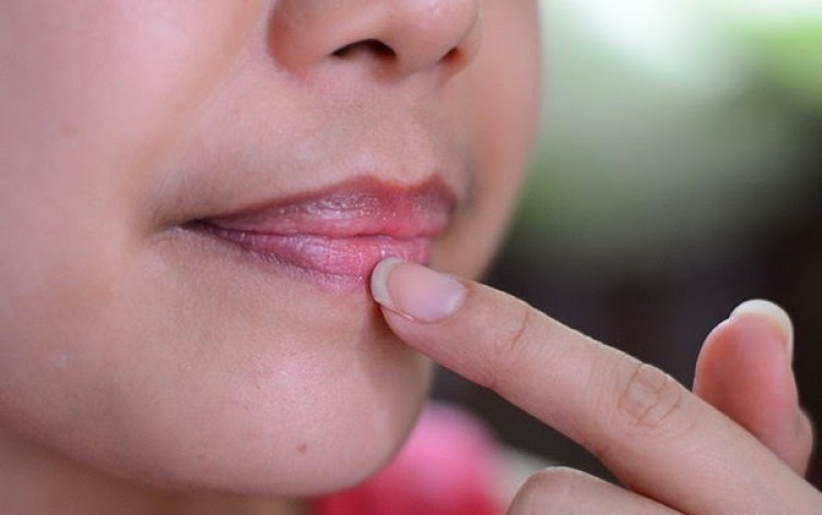 cara alami mengatasi bibir hitam